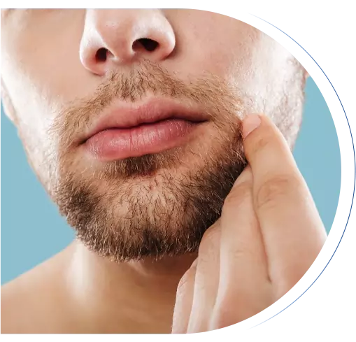 Greffe de barbe en Tunisie