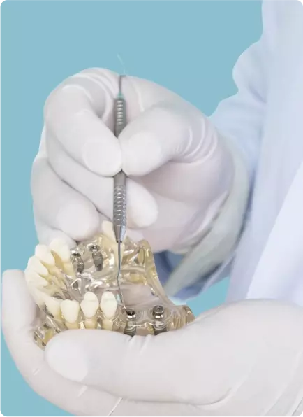 Implant dentaire en Tunisie avec Aram Clinic